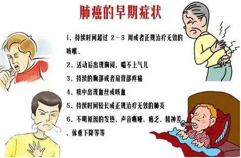 肺癌的早期癥狀和前兆
